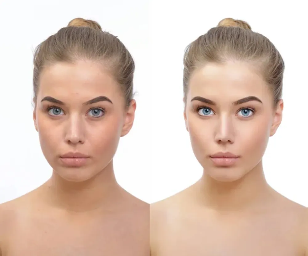 Personalized aesthetic treatment