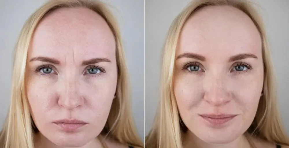 Aesthetic care and skin wellness